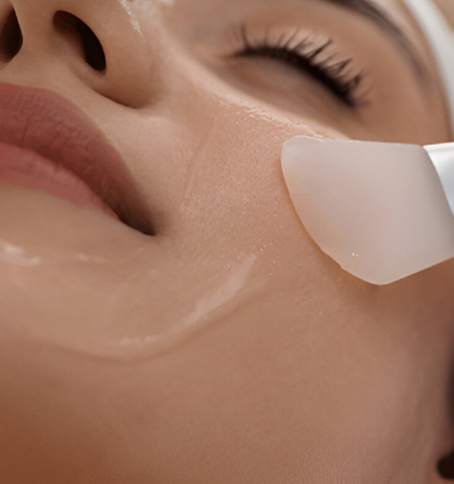 Chemical Peel