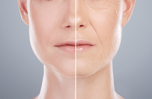 Anti-Aging