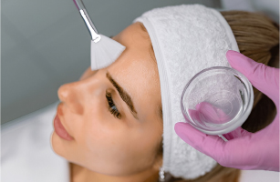 Chemical Peel