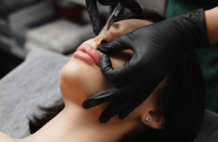 Filler Treatments
