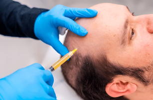 PRP Therapy