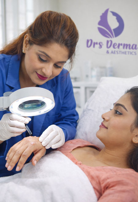 Viral Wart Removal 1